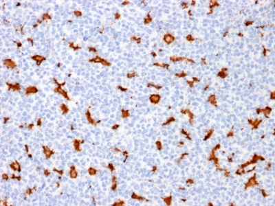 Formalin-fixed, paraffin embedded human tonsil sections stained with 100 ul anti-AIF1 (clone AIF1/1909) at 1:200. HIER epitope retrieval prior to staining was performed in 10mM Citrate, pH 6.0.